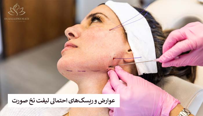 عوارض و ریسکهای احتمالی لیفت نخ صورت
