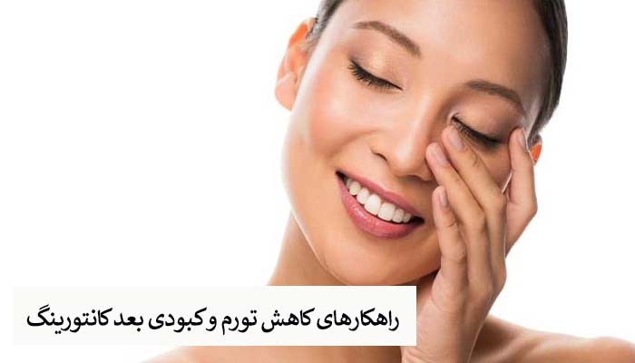 راهکارهای کاهش تورم و کبودی بعد کانتورینگ